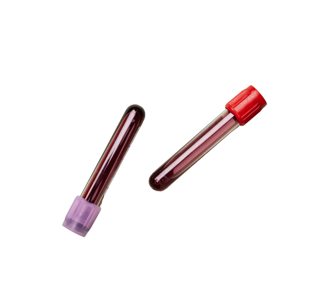 kraujo-testas Kraujo Tyrimai